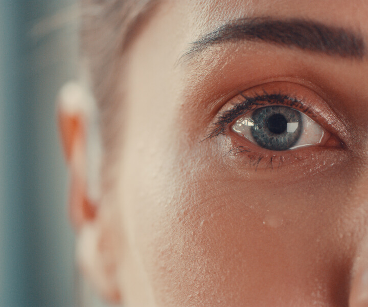 Close up of a woman suffering from a retinal tear