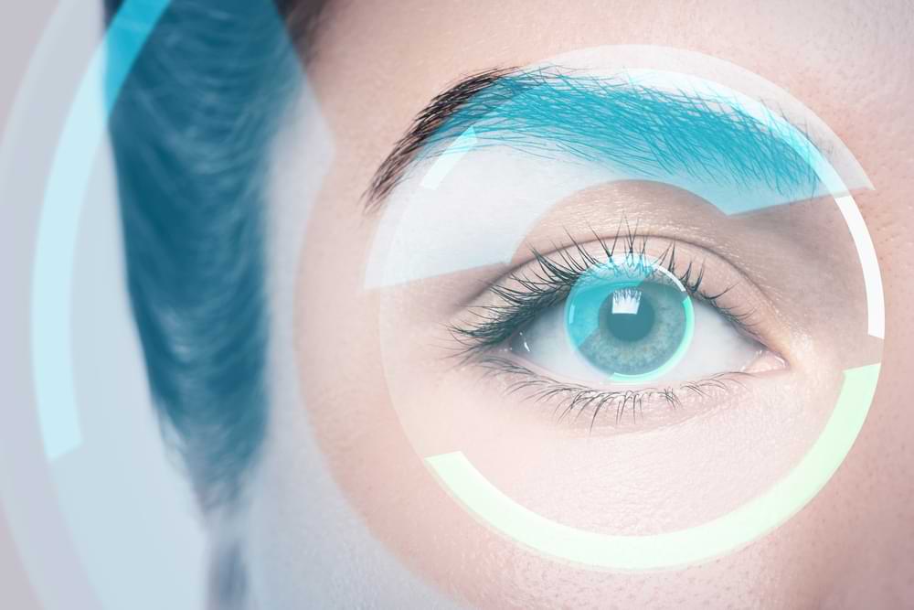 LASIK surgery in Sydney